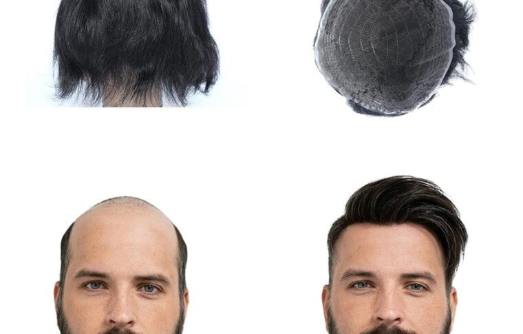 Solutions for Men